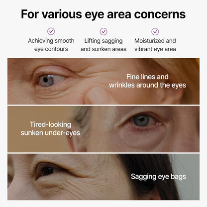 CalciBright UnderEye Cream